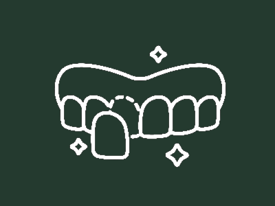 Veneers